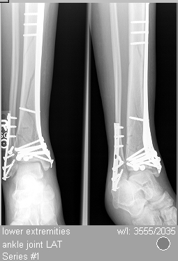 after.jpg